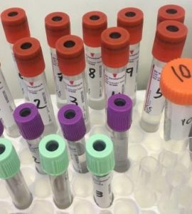 traamientos neuroblastoma